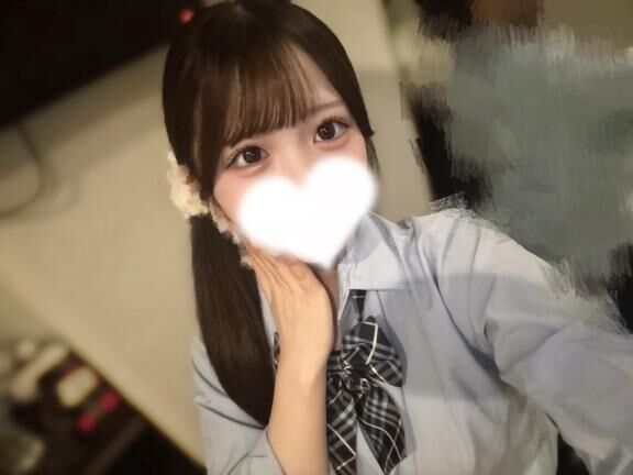火傷、、、